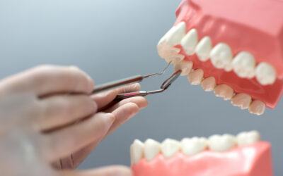The Importance of Oral Hygiene Between Dental Visits