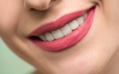 Signs You Might Need a Teeth Whitening Treatment: Is It Right for You?